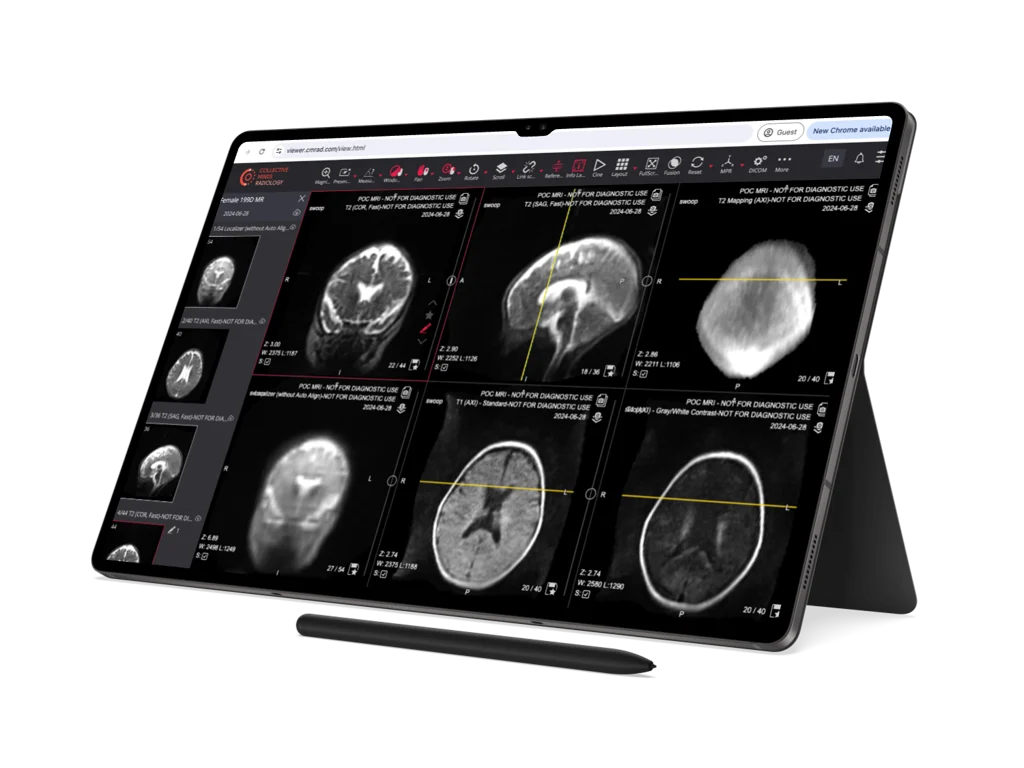 Collective Minds DICOM Viewer on Tablet